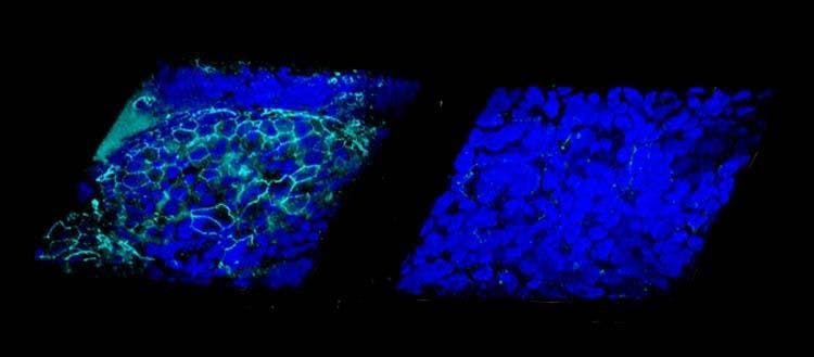 À gauche: l’hydratation restaure l’étanchéité de la surface des voies respiratoires. En turquoise, les jonctions entre les cellules épithéliales (bleu). A droite: voies respiratoires atteintes de mucoviscidose.