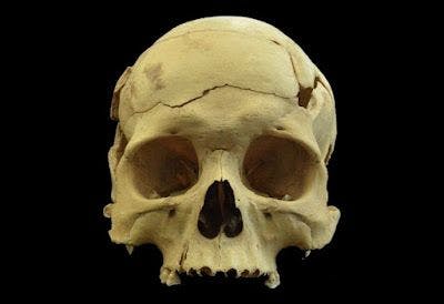 La découverte d'un crâne révèle l'une des premières craniectomies