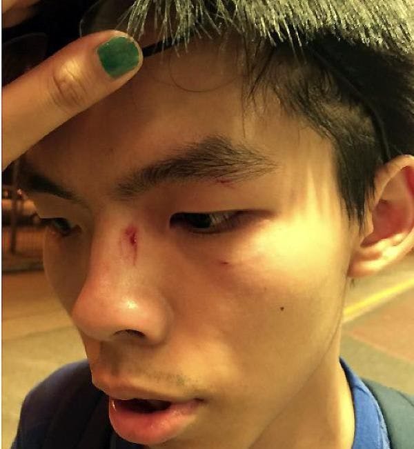 Le jeune homme a été frappé au visage.