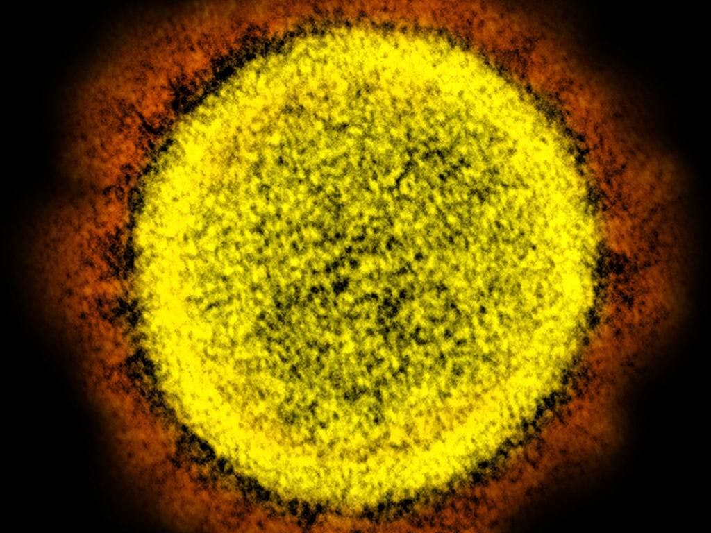 L’étude a été menée avec des niveaux fixes de SARS-CoV-2, correspondant probablement au pic d’une infection, et en l’absence d’exposition à une lumière ultraviolette pouvant rapidement altérer le virus (archives).