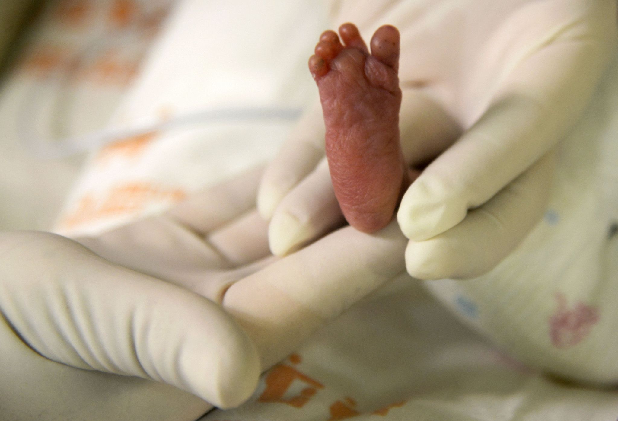 Mortalité infantile au plus bas, mais les progrès sont lents et «précaires»